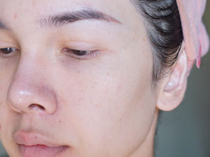 เคล็บไม่ลับ ผิวใสเหมือนดารา ด้วย Aura Miracle Visage