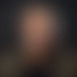 Perte de cheveux : que faire ? Toutes les solutions pour retrouver confiance et style