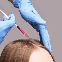 Plasma for Hair Loss