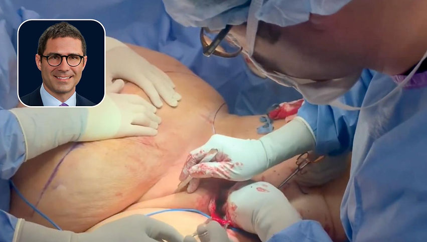 Buried Penis Repair in a Post-Bariatric Patient: Panniculectomy & W-Plasty Reconstruction