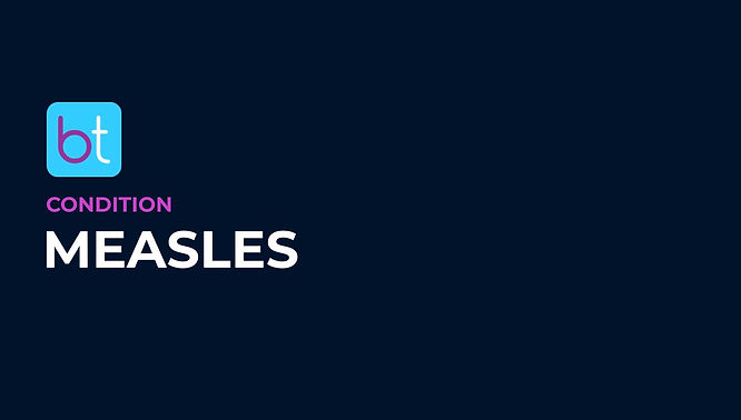 Measles Condition Overview