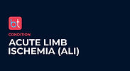 Acute Limb Ischemia (ALI) Podcasts