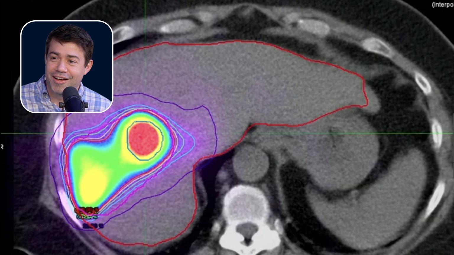 Y90: Treatment Planning for a Small HCC Lesion in a Liver Transplant Candidate