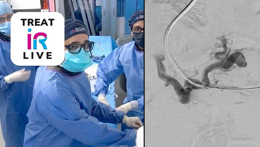 TREAT iR LIVE: TIPS with Portal Recanalization (March 2025)