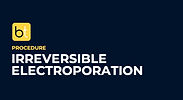 Irreversible Electroporation Procedure Prep