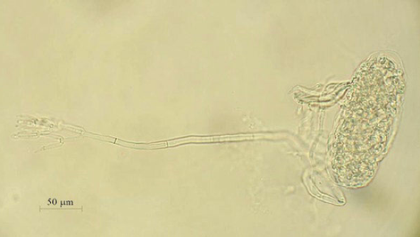 The Complete Guide to Paecilomyces lilacinus: Nature's Powerful Biological Nematicide