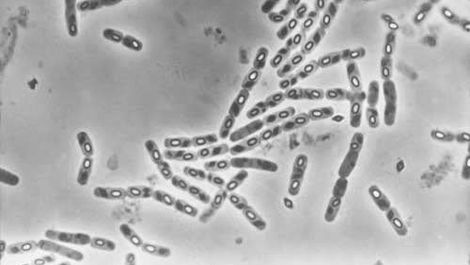 Bti represents a cornerstone of modern, environmentally responsible mosquito control. Its exceptional safety profile, proven effectiveness, and minimal resistance development make it an ideal tool for protecting public health while preserving environmental integrity. 