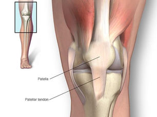Patellar Tendinit Nedir? Ağrısı Nasıl Geçer?