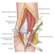 メディカルイラスト, Medical illustration