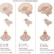 brain surgery, medical illustration, anatomy, brain illustration