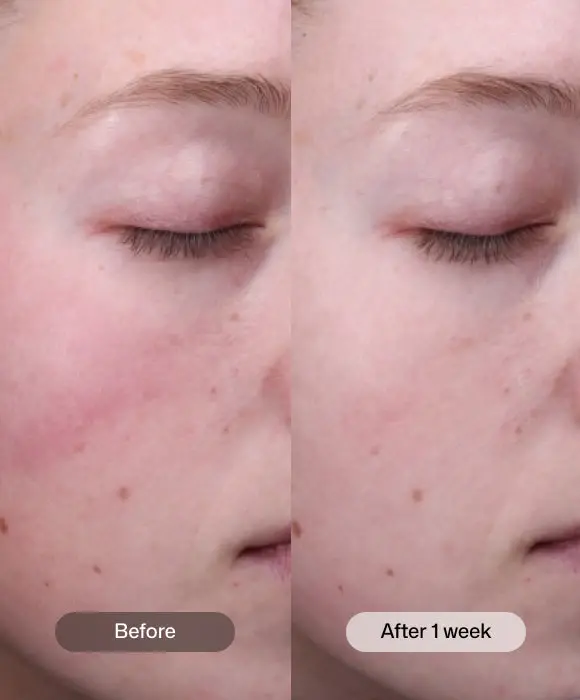Thumbnail: Radiance+ Resurfacing Serum (1 oz. dropper bottle)