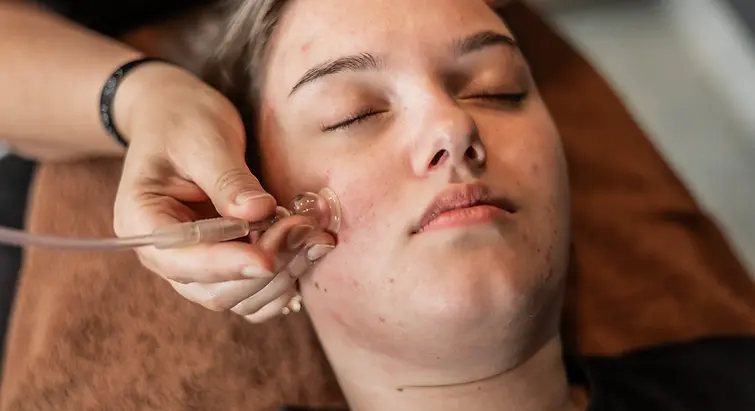 Perfect Skin Clinic Behandeling
