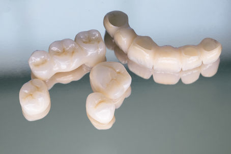 How to cement Zirconia crowns