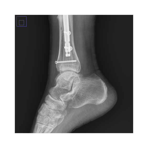 Miniatura: Rayos x Portátil Digital iRay mod. iDR 650E