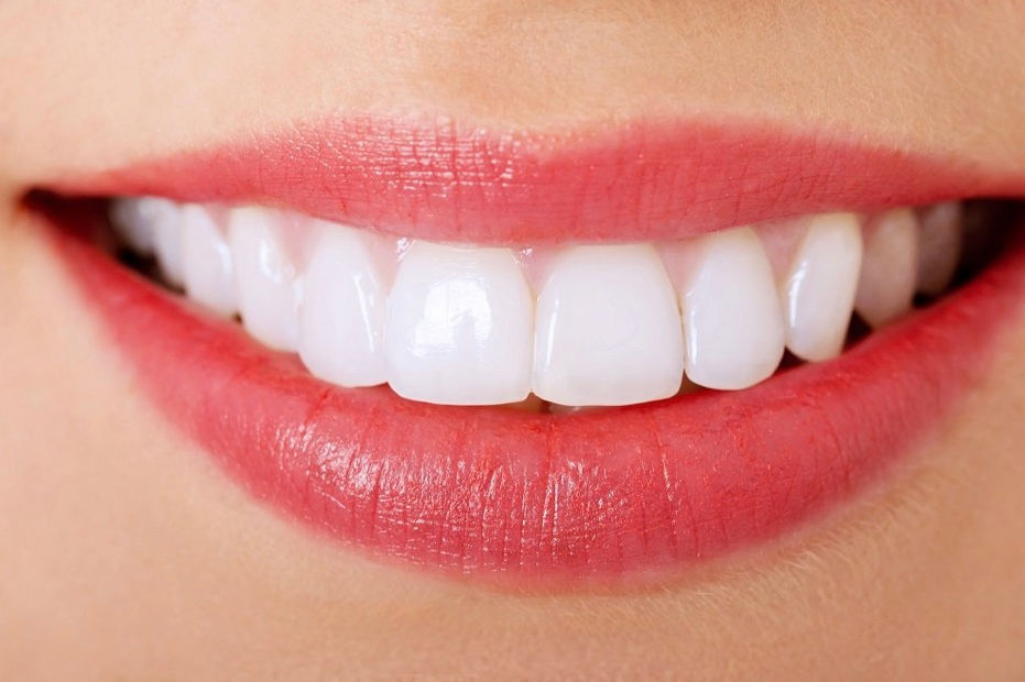 Beautiful smile dentist Milpitas