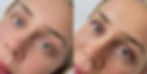 ree
