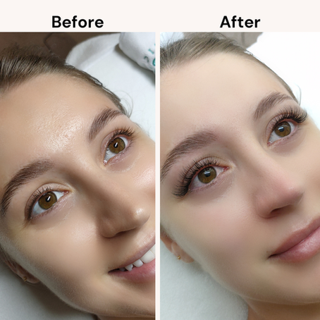 Before and after of lash transformation with volume eyelash extensions at Skinlash Singapore beauty salon.