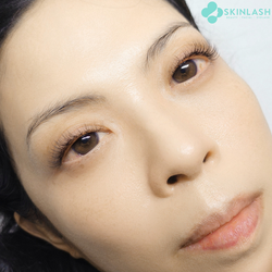 Skinlash & Hairform (7)