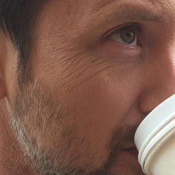 partial old age (crows feet)