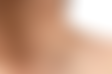 Understanding Skin Tags: Causes, Symptoms, and Treatment Options