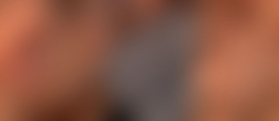 Bastidores da beleza: quem responde por uma reação alérgica causada por maquiagem?