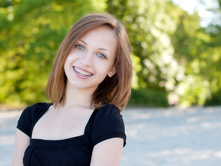 Is Invisalign Teen Expensive?