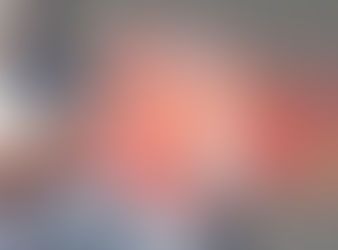 Uro-Oncology Explained: Kidney Cancer Risk Factors Made Simple