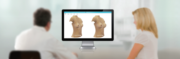 3D-simulation-body-feminisation-surgery-