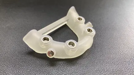MH Dental China All-on-4 implant
restoration