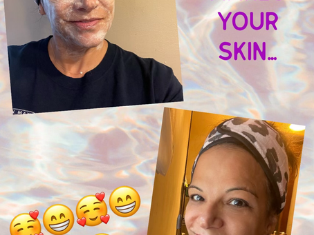 Why wash your face daily?