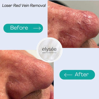 Before and after skin treatment