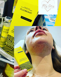 A woman's lower chin with facial marks