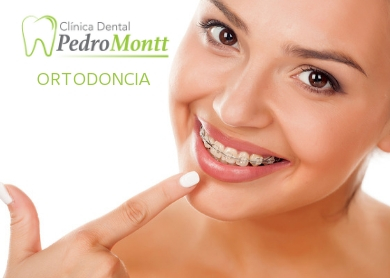          7 Beneficios de la Ortodoncia