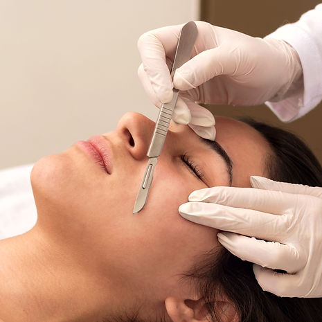 procedure-dermaplaning.jpg