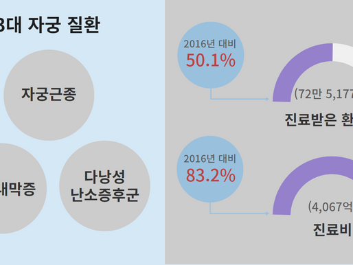 미레나 시술 괜찮을까? 당신의 자궁 건강은 중요하다.