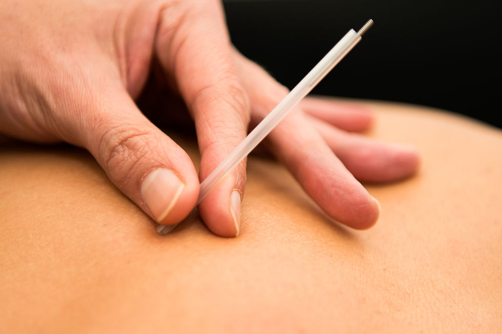 Dry Needling