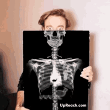 upreach-animation.gif