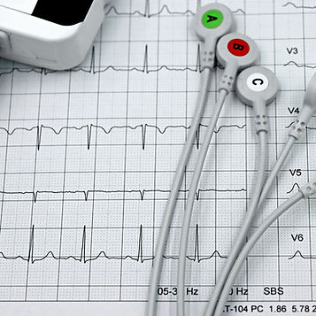 Cardiología-Ocmi-2.jpg