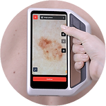 csm_2024-Skeen--Boebbel-Device-SingleHanded-800x800_72e5303b89.png