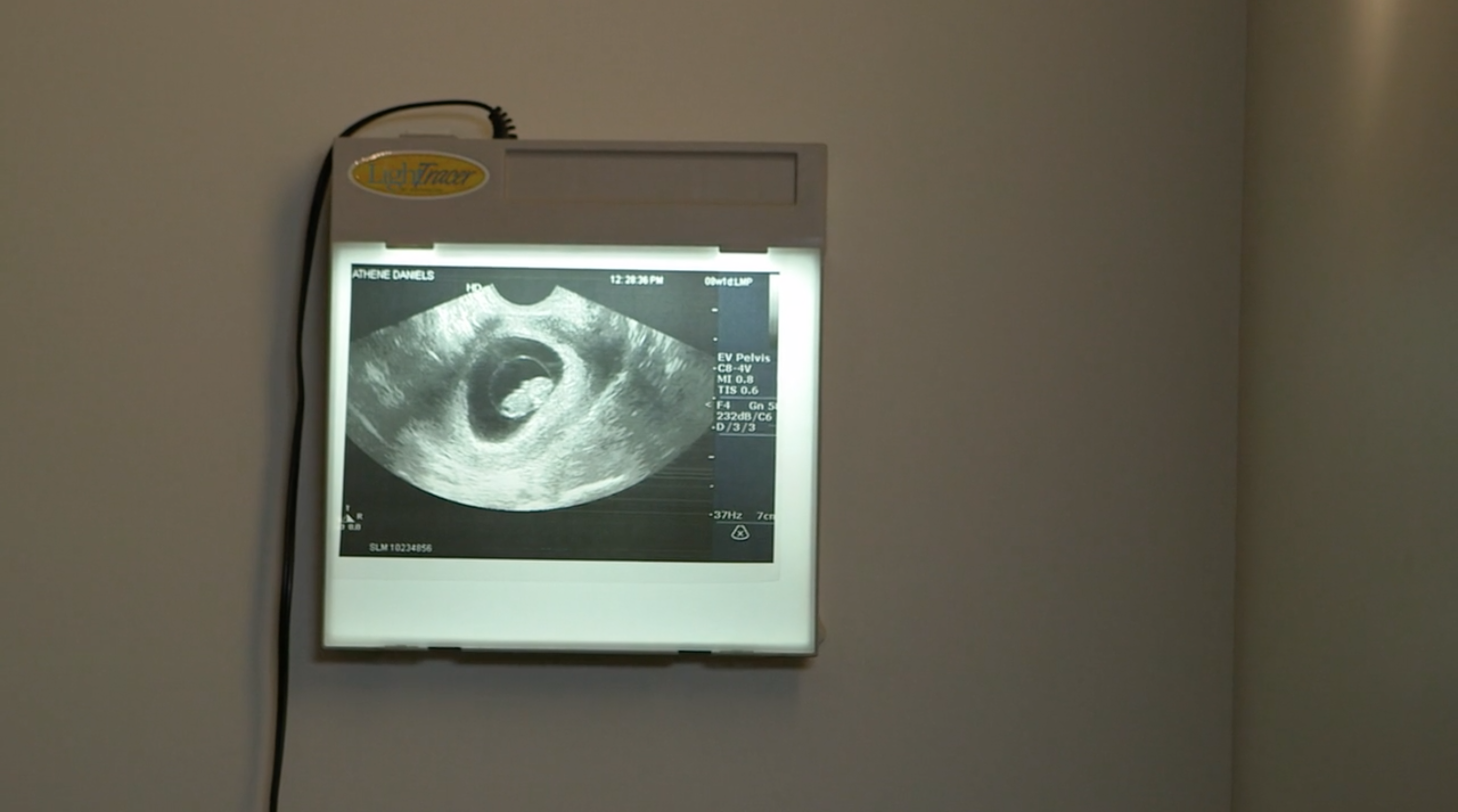 Ultrasound Image for To Be