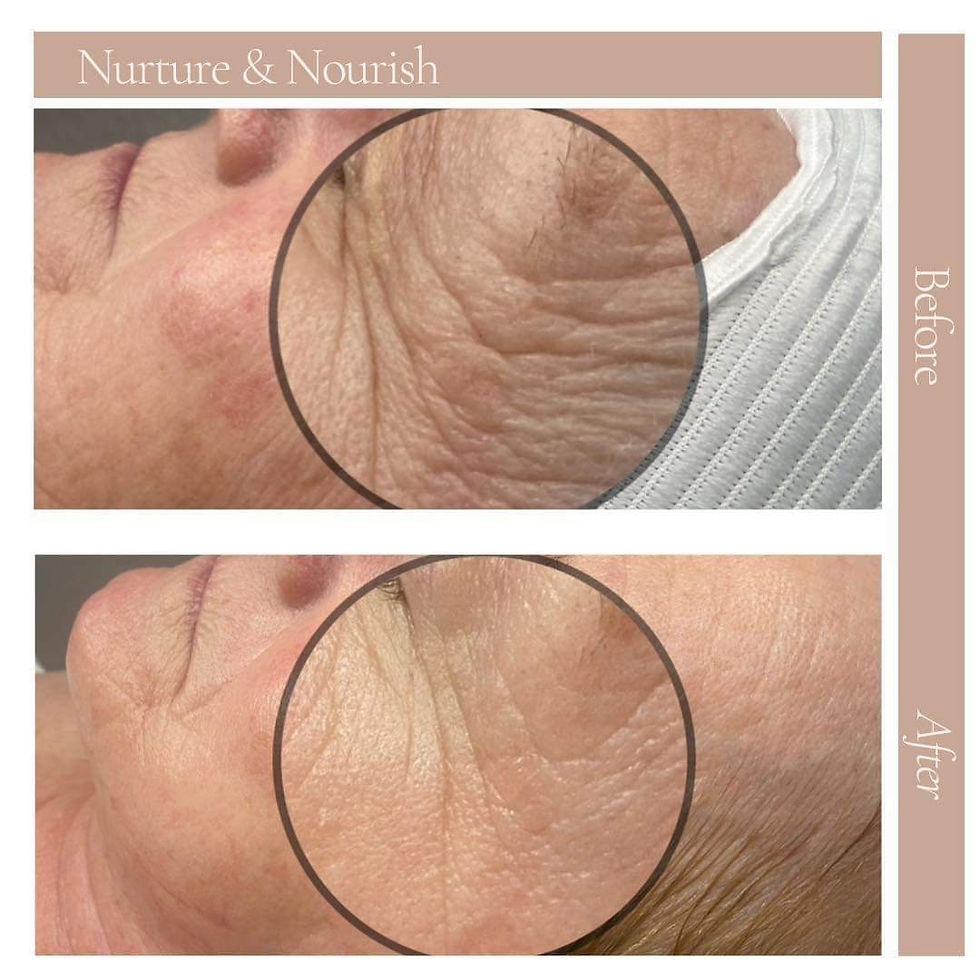 Before and After Aging