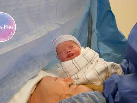 Choosing to have a C Section birth