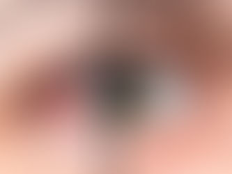 ¿Qué es ojo seco?