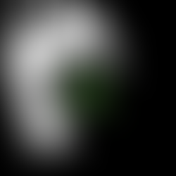 Comment vaincre l'anxiété avec le CBD ?