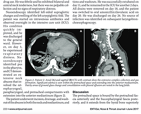Idiopathic pretracheal deep neck space infection with mediastinal extension: A series of 3 cases and review of the literature: