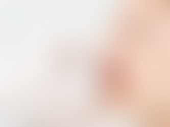 Địa Chỉ Nâng Mũi Cấu Trúc Uy Tín – Nên Dựa Vào Tiêu Chí Nào?