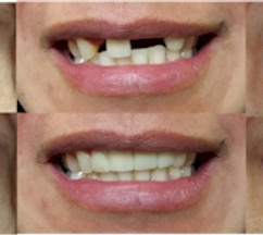 All before and after.jpg