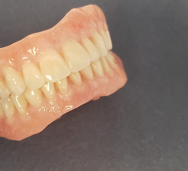 Complete Upper and Lower Dentures