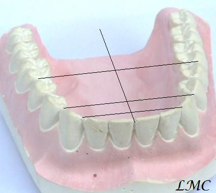 Symétrie dans la dentition