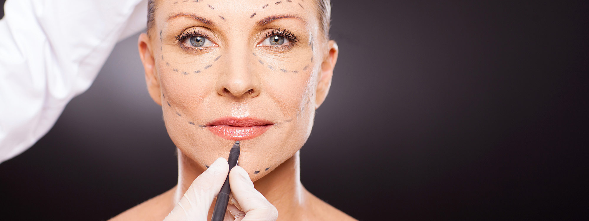 Lifting du visage en Tunisie : techniques, tarifs et séjour tout-compris à Tunis